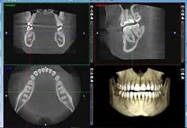 CBCT Interpretation